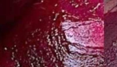 Boost your collagen with these fantastic beetroot recipes to enjoy every evening.
