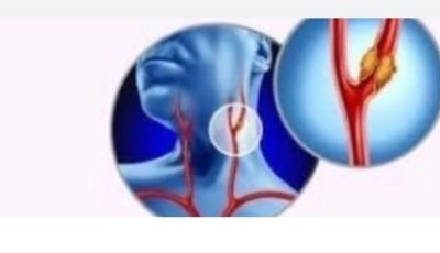 High Cholesterol: The Silent Enemy That Rarely Shows Its Face